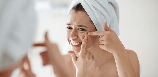 Achieve Clear, Radiant Skin: Your Comprehensive Guide to Acne-Free Living